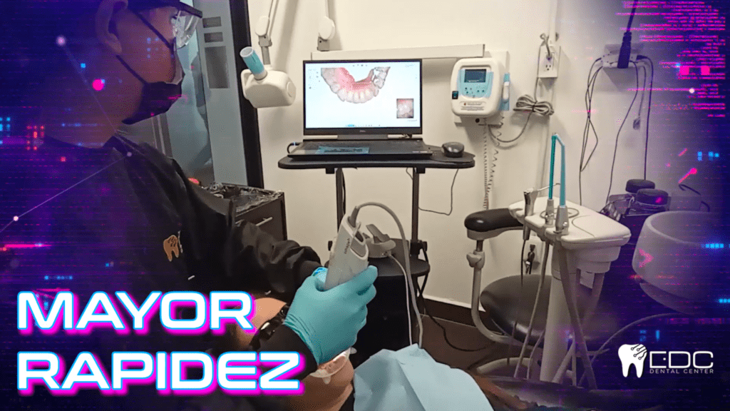 Escáner intraoral en la consulta dental