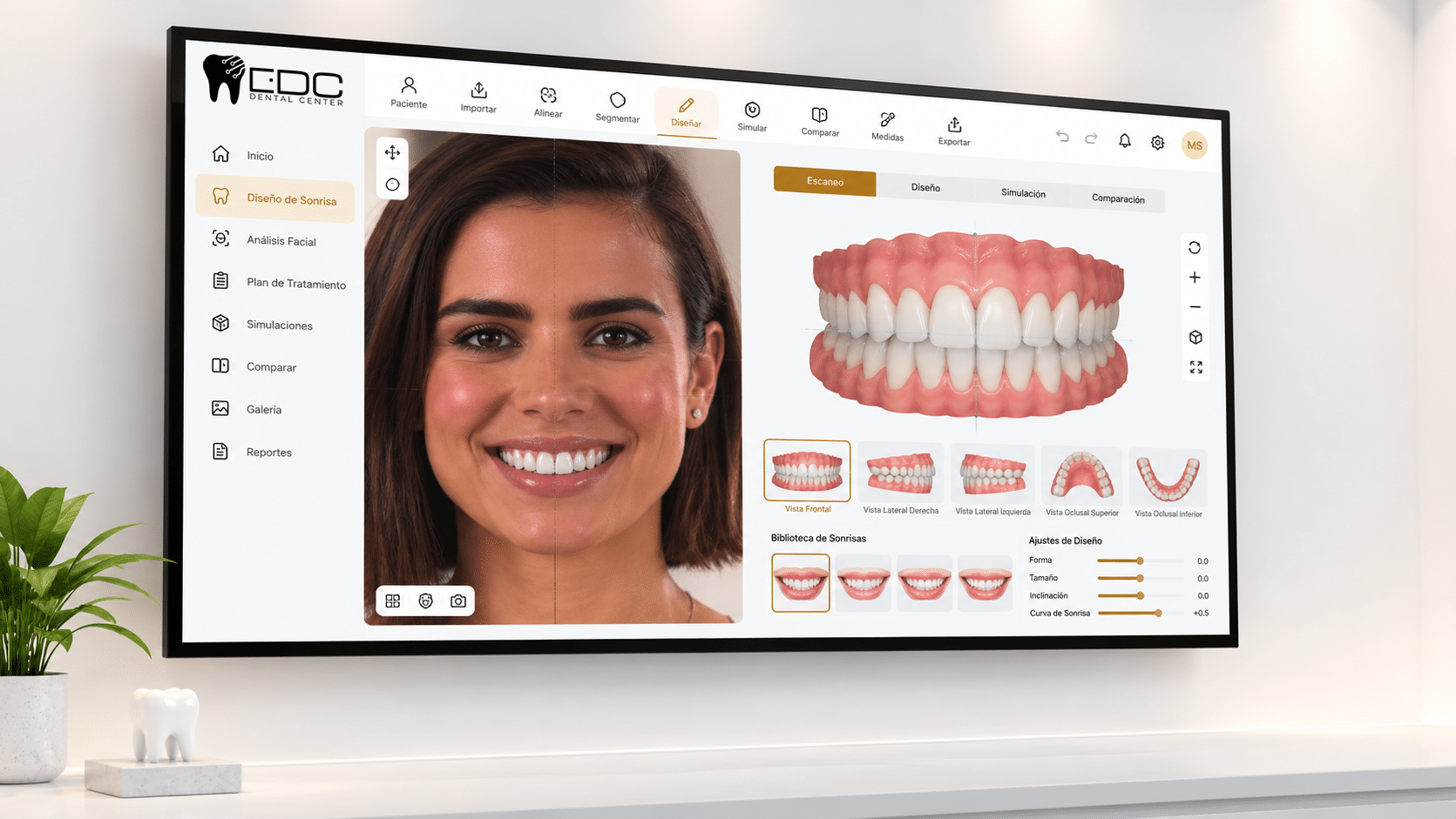 implantes dentales antes despues